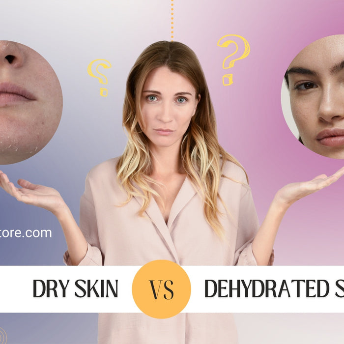 Dry Skin Vs Dehydrated Skin: Know The Difference & Get Relief