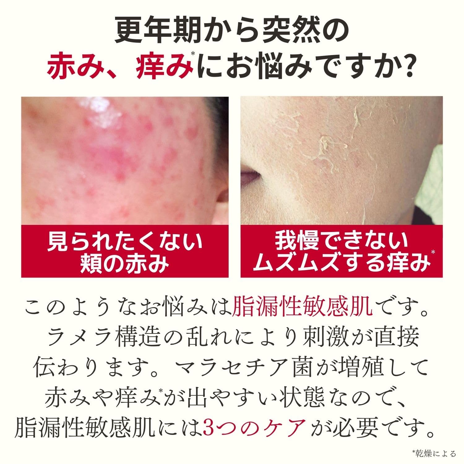 Doctor Re9 Creture Jelly Lotion Ex 60ml - Relieve Menopausal Redness & Itchiness