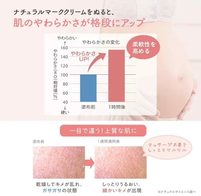 Mama & Kids Natural Stretch Mark Remediation Cream 150g