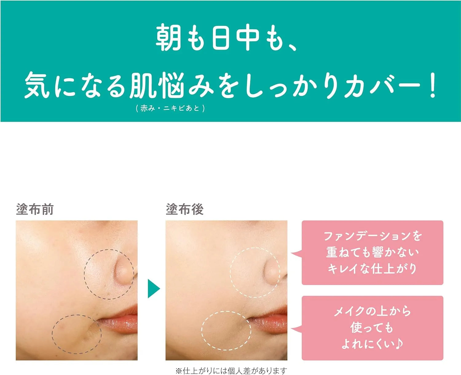 Sana Bare Skin Anniversary Medicated Acne Concealer Powder for Repair and Cover SANA