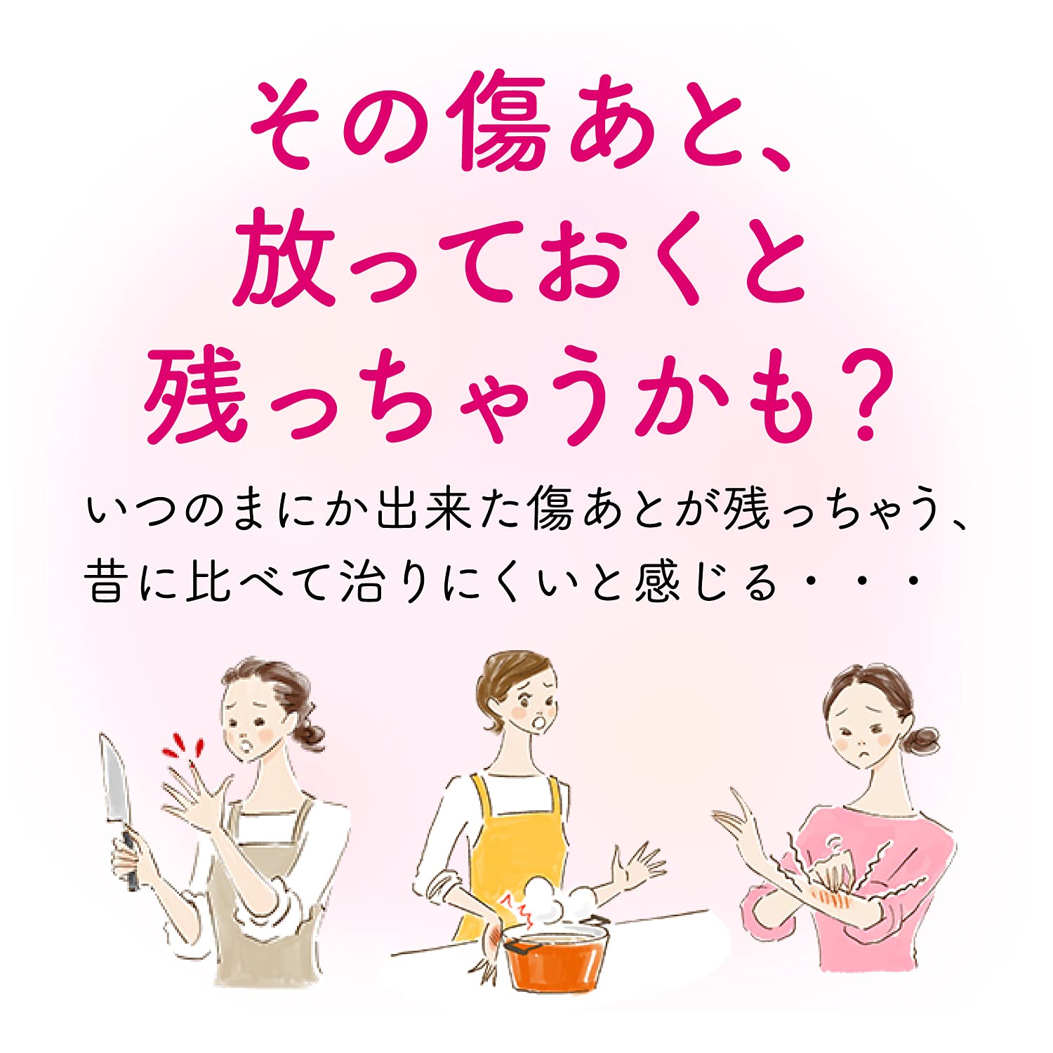 Attonon Ex Cream 15G - 2Nd-Class Otc Drug From Japan