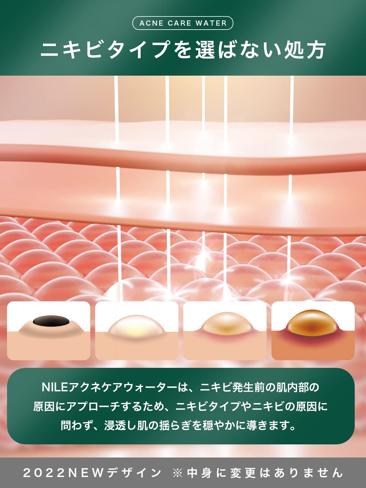 Nile Acne Lotion Men'S Women'S Quasi-Drug 150Ml