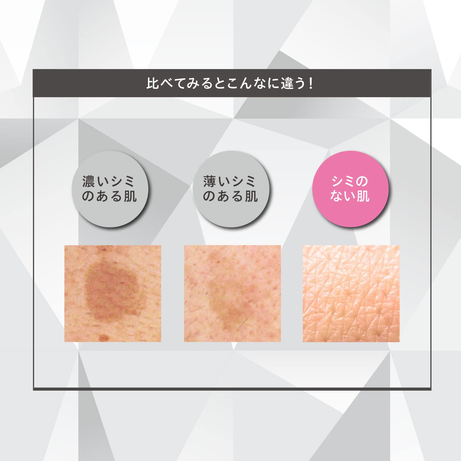 Kose One By Kose Limited Large Size Melano Shot White D 90ml - Japanese Brightening Serum