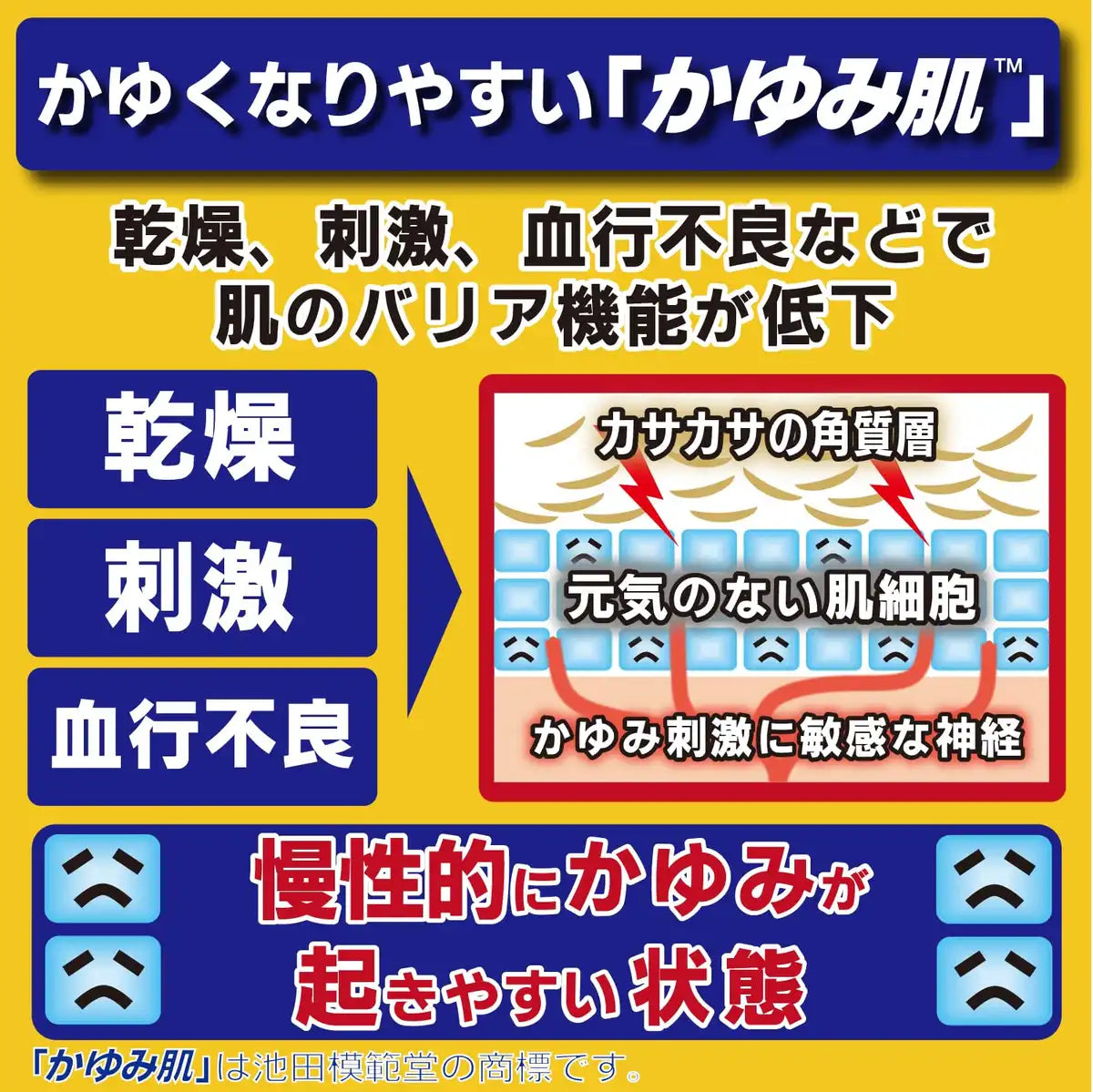 Itchy Skin Treatment Muhisoft GX 150g | Ikeda Model Hall [Third-Class OTC Drug]