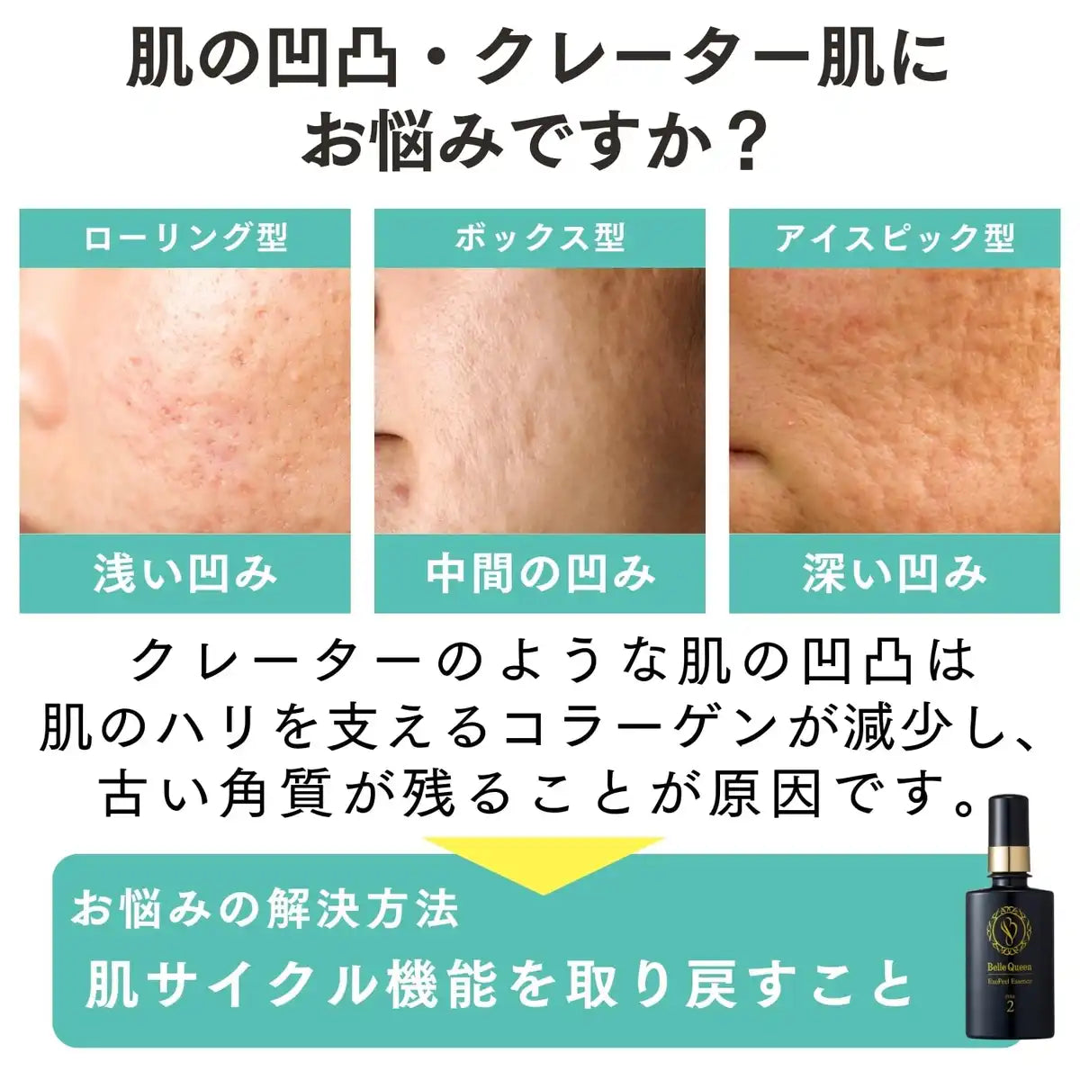 ドクターRe9 Belle Queen ExoPeel Essence 45mL
