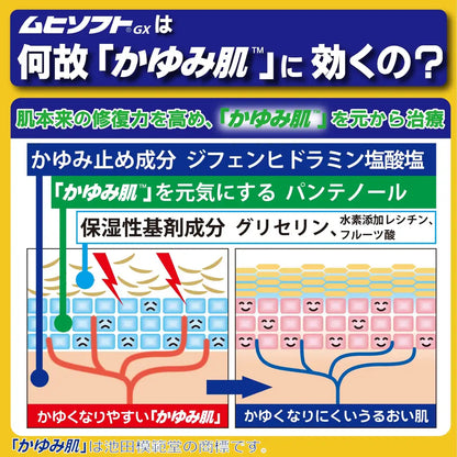 Itchy Skin Treatment Muhisoft GX 150g | Ikeda Model Hall [Third-Class OTC Drug]