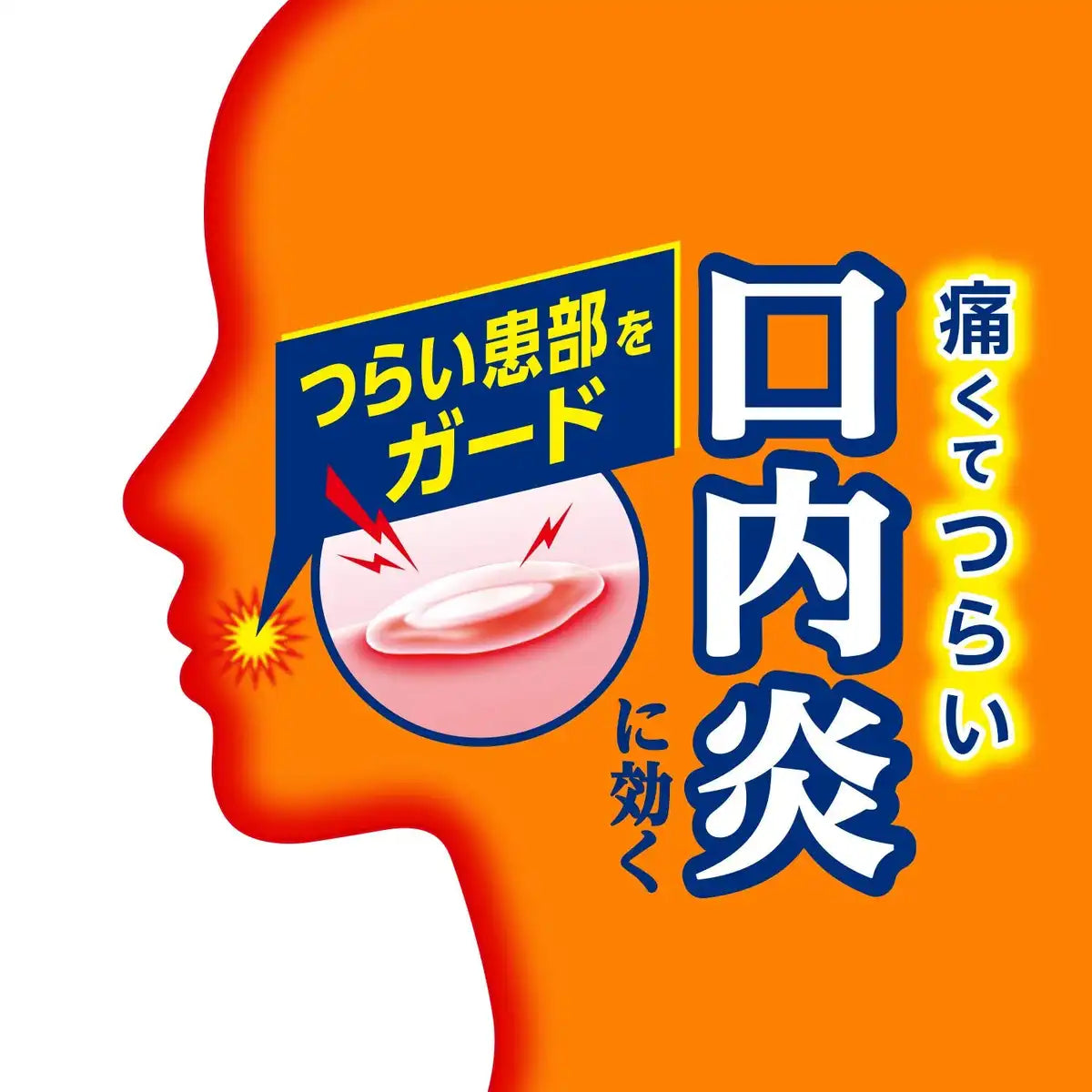 Sato Pharmaceutical Afutaguard 5G Oral Pain Relief Gel - [Class 2 OTC Drug]
