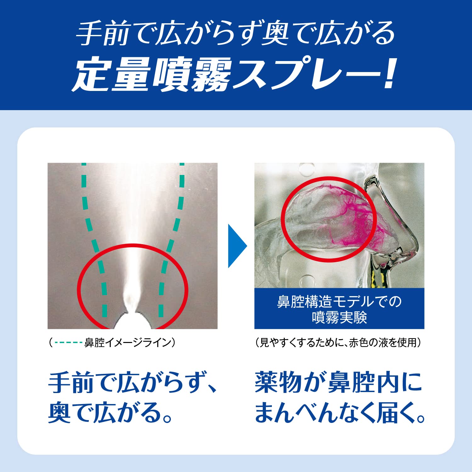 Pablon Nasal Spray 30ml - Fast Relief [Class 2 OTC Drug]