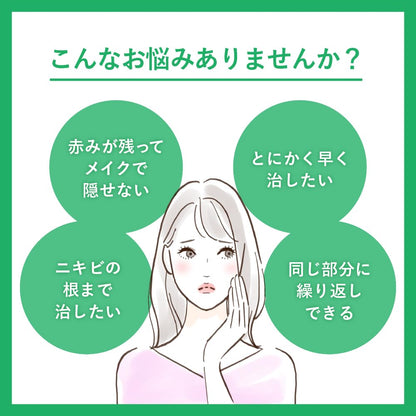 Rohto Pharmaceutical Mentholatum Acnes 25 Medical Cream 16G – [Class 2 OTC Drug]