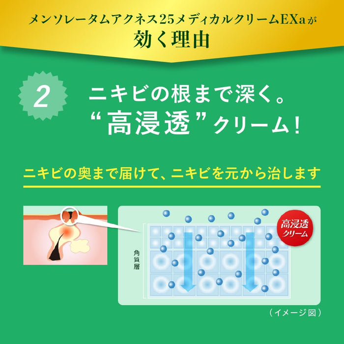 樂敦製藥 Mentholatum Acnes 25 醫用霜 16G – [第 2 類非處方藥]