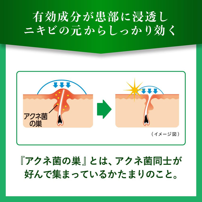 乐敦制药曼秀雷敦 Acnes 25 药用喷雾 B 100ml | [第 2 类非处方药]