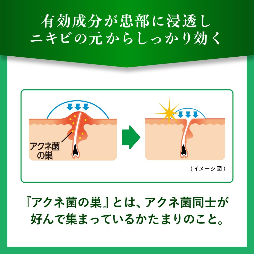 Rohto Pharmaceutical Mentholatum Acnes 25 Medical Mist B 100ml | [Class 2 OTC Drug]