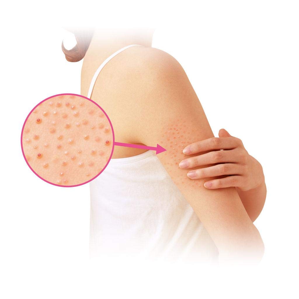 Kobayashi Pharmaceutical Ninocure A 30G Class 3 OTC Drug