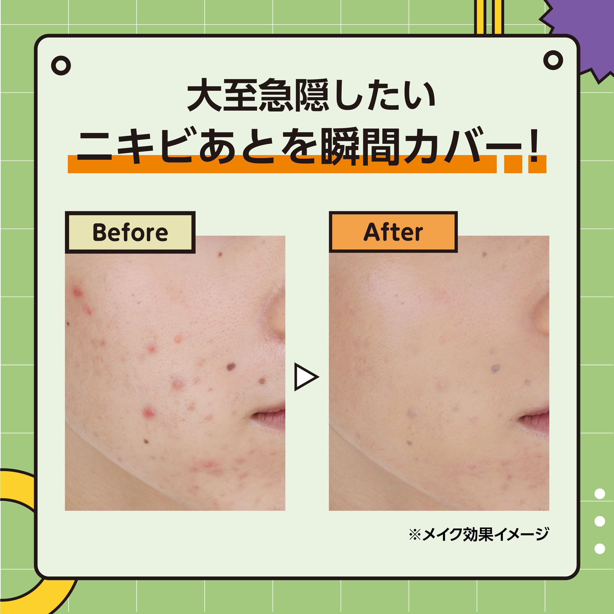 Club Cosmetics Teitoku T8K Acne Concealer Light Beige 10 Coverage