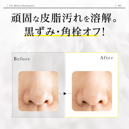 Dr365 Vc Release Gel Cleanser with Vitamin C for Sensitive & Dry Skin 100g