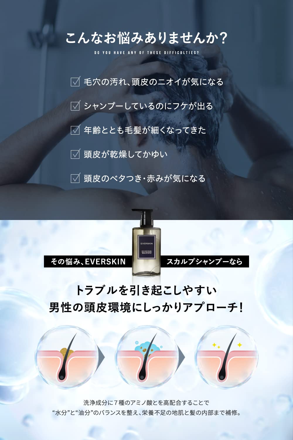 Everskin Rich Foam Scalp Shampoo for Men Hair Growth 300ml Japan Made