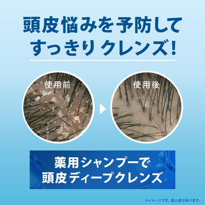 H&S Repair Intensive Treatment for Damaged Hair 180g