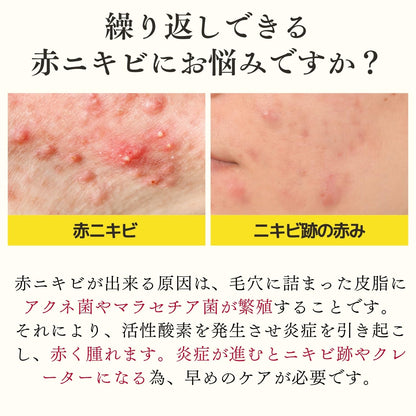 Doctor Re9 Berlian VC Lotion - Medicated Acne Care Hypoallergenic 80ml.