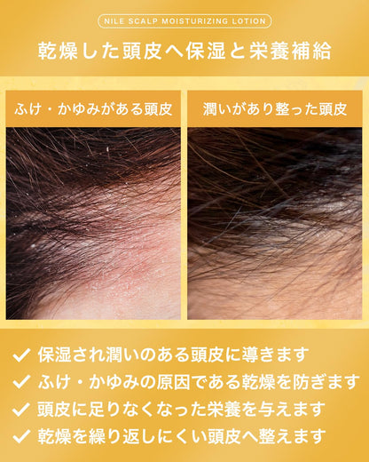 Nile Scalp Moisturizing Lotion for Dandruff Relief and Dry Scalp Care