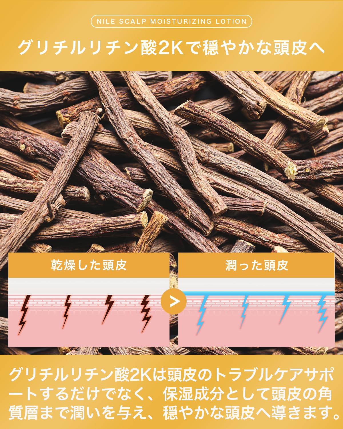 Nile Scalp Moisturizing Lotion for Dandruff Relief and Dry Scalp Care