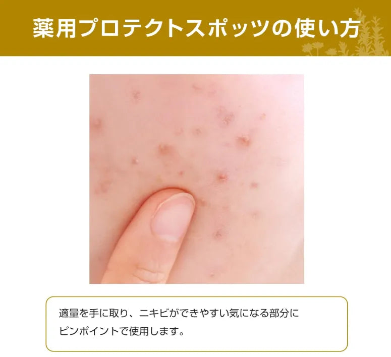 Acne Barrier Medicinal Protect Spots Intensive Care 30ml - Japan Beauty Serum