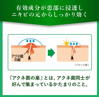 Mentholatum Acnes 25 Medical Mist B 100Ml (2 Drugs) - Japan