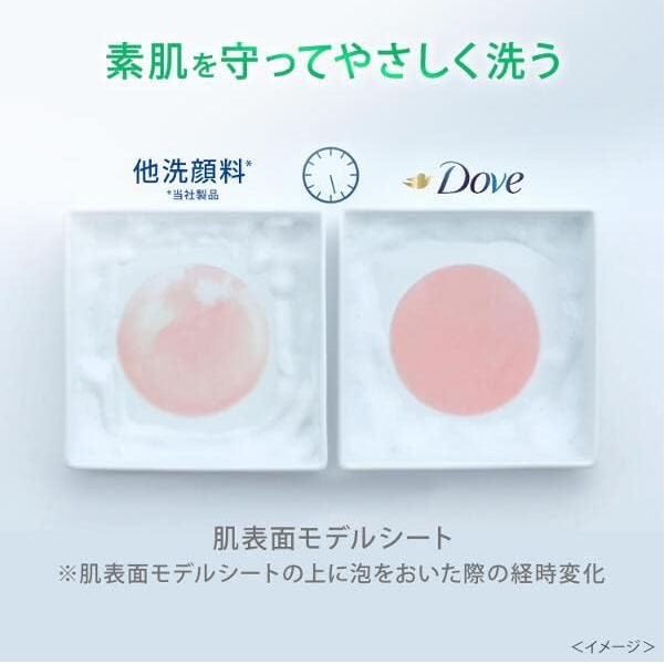 Unilever Dove Acne Care Creamy Bubble Face Wash 160ml - Face Wash For Acne-Prone Skin