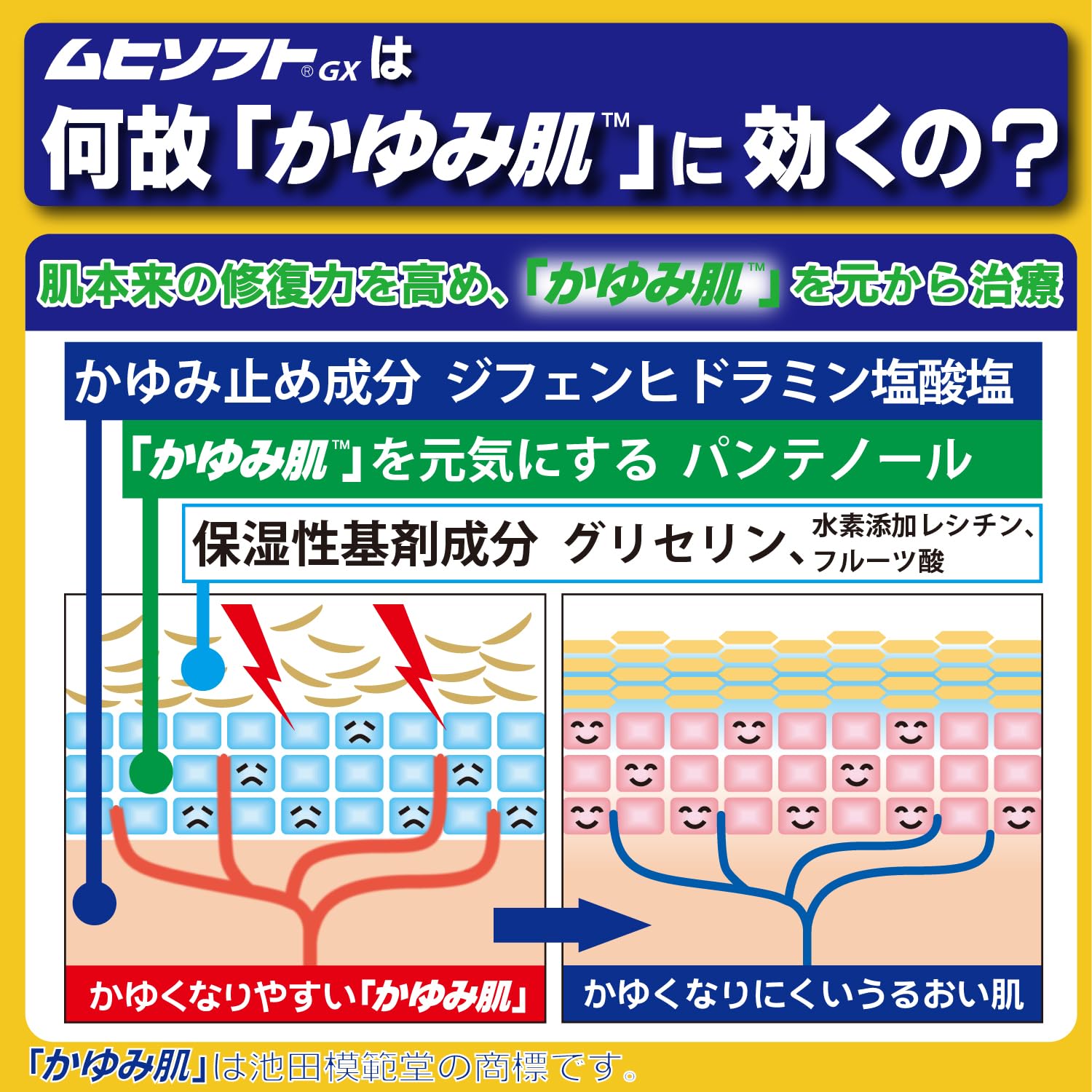 Itchy Skin Treatment Muhisoft GX 150g | Ikeda Model Hall [Third-Class OTC Drug]