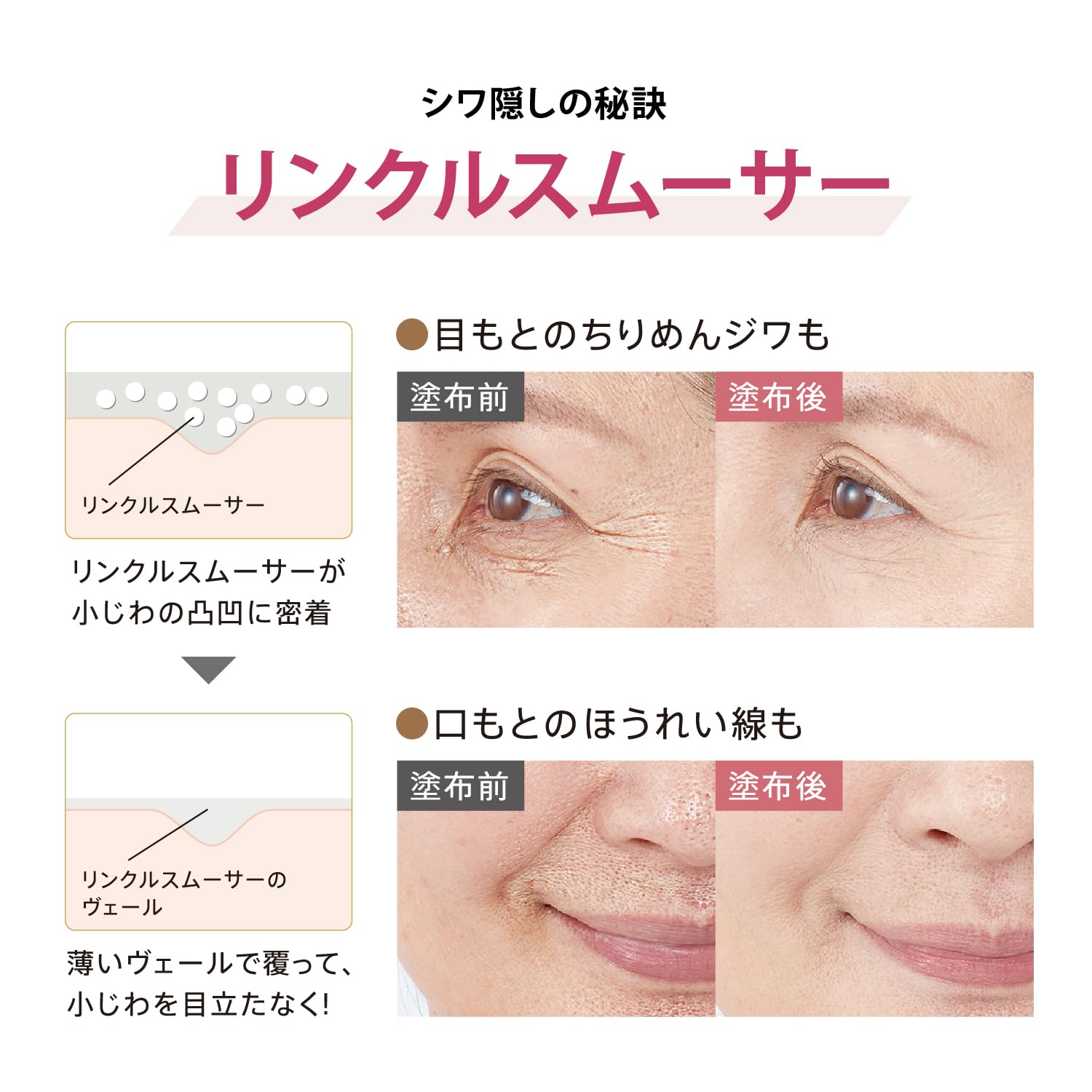 Ya-Man Medilift Needle Lift Wrinkle Smooth Base Cream YML0038