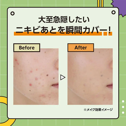 Club Cosmetics Teitoku T8K Acne Care Concealer 20 Natural Beige