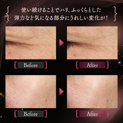 Fancl Advanced Beauty Concentrate Refill Serum