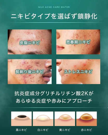 Nile Acne Toner for Men and Women Over-the-Counter Drug