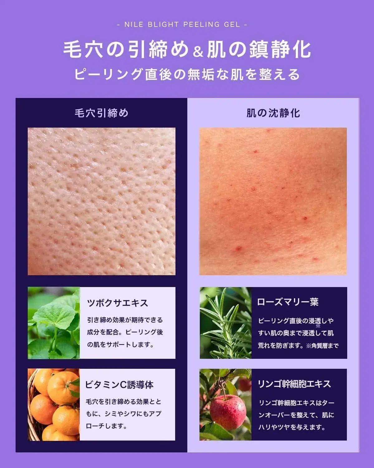 Nile Peeling Gel for Exfoliating and Removing Dead Skin Face