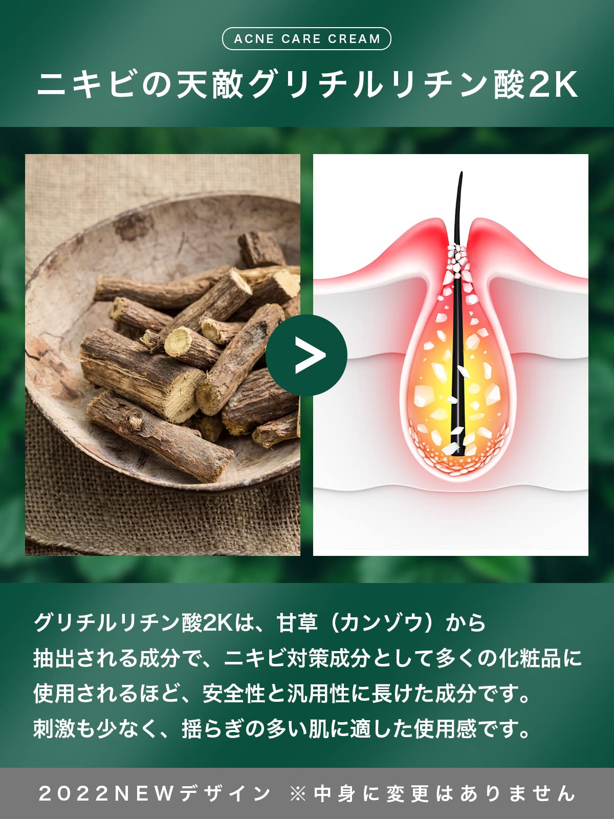 Nile Acne Cream Men&#39;S Women&#39;S After Sun Care Quasi Drug 50G