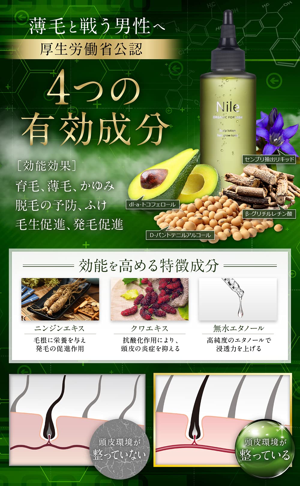 Nile Hair Tonic For Men Scalp Hair Lotion Quasi-Drug 150Ml