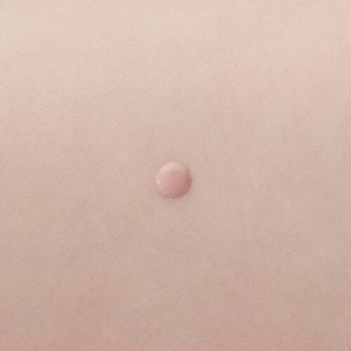 Potunt Spot Powder Essence Ac Care Serum - Japanese Beauty Essence Must Try