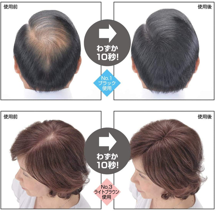 Ruan Super Million Hair 20G No.1 Black For Thinning Hair Loss Alopecia Areata Gray Hair Japan