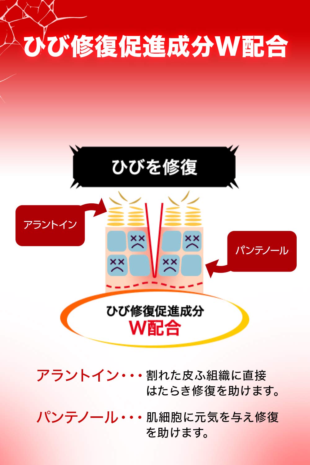 Ikeda Mohando Japan [Third Drug Class] Crack Care Ointment 35G