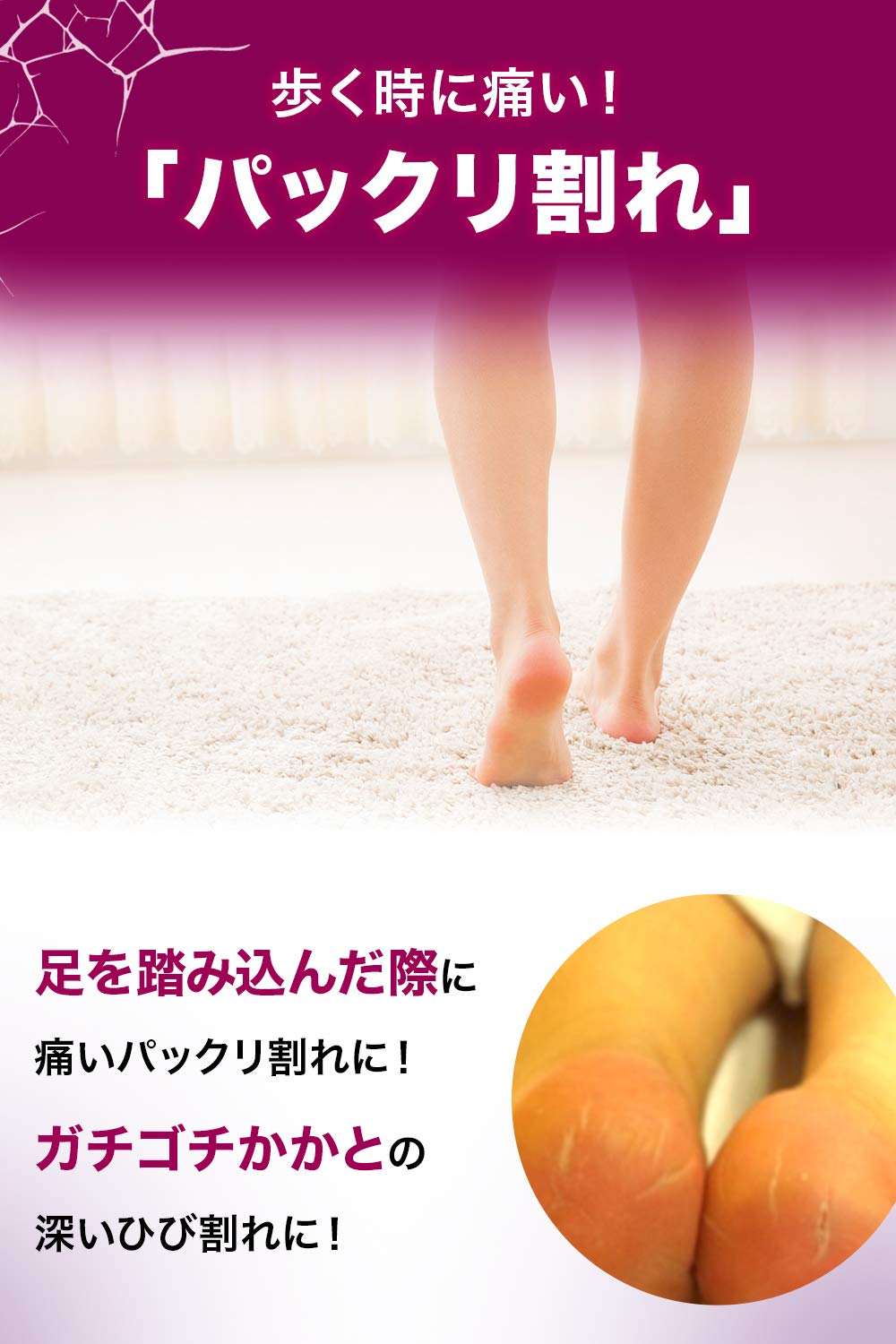 Ikeda Mohando Japan Hibikea Ft Ointment 20G [Third Drug Class]